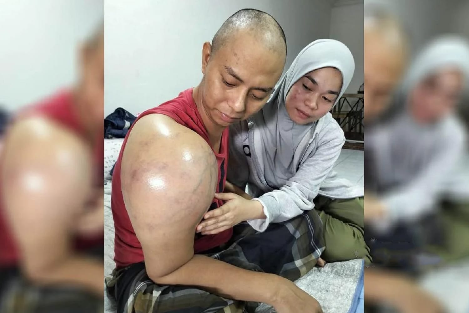 'Ingat sakit bahu biasa, rupanya kanser tulang' - pemuda baru kahwin terkejut dimaklum doktor